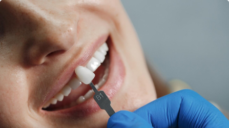 Prótese dentária
